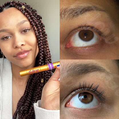 iGlow Lash &amp; Brow Maximizer + iGlow Under - eye Patches - iGlow Cosmetics