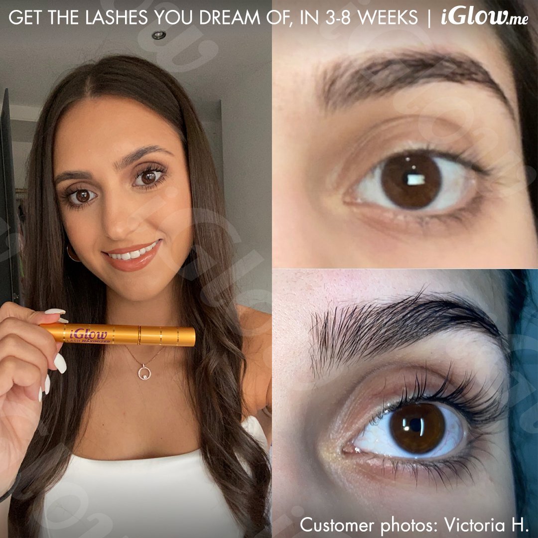 iGlow Lash &amp; Brow Maximizer + iGlow Under - eye Patches - iGlow Cosmetics